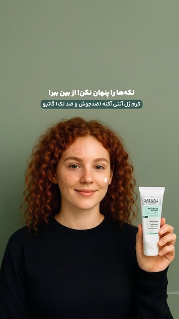 کرم ژل گاتیو